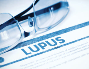 Lupus Coding Tip